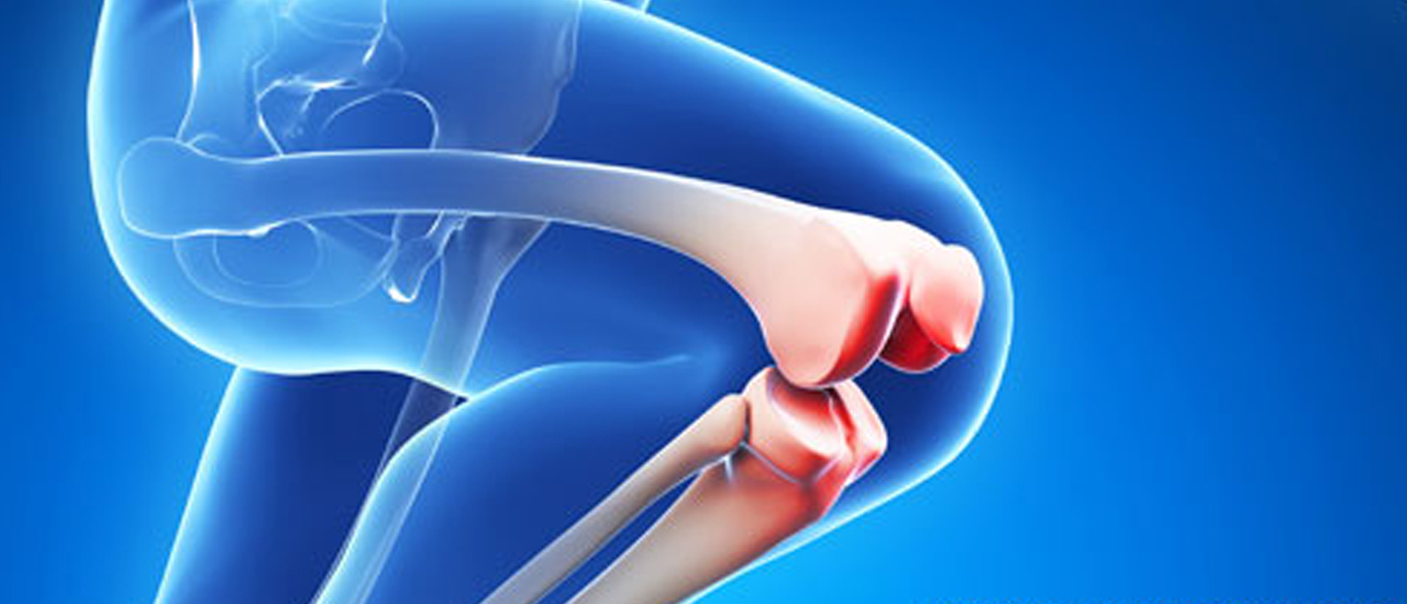 Revision joint surgery